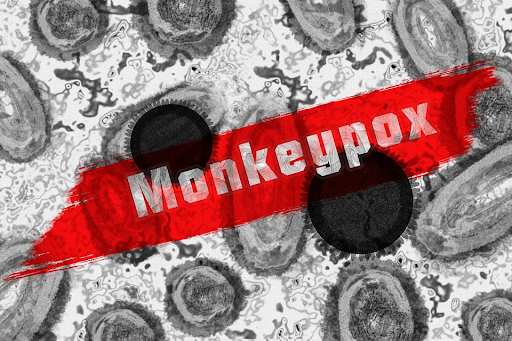 The World Health Organization renamed monkeypox to mpox in hopes of reducing racial stigmas associated with the former name.